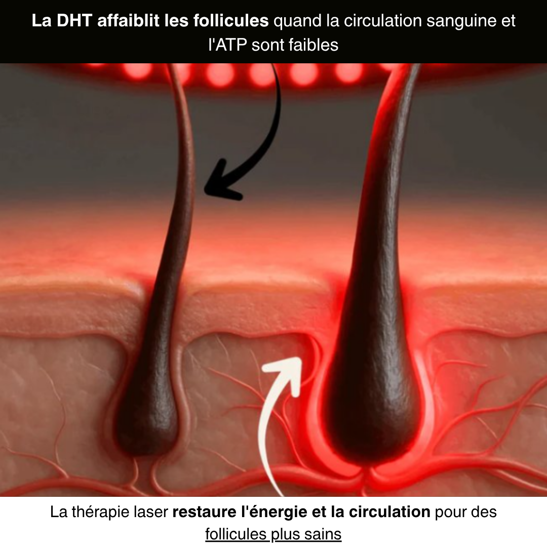 Casquette Renaissance Capillaire