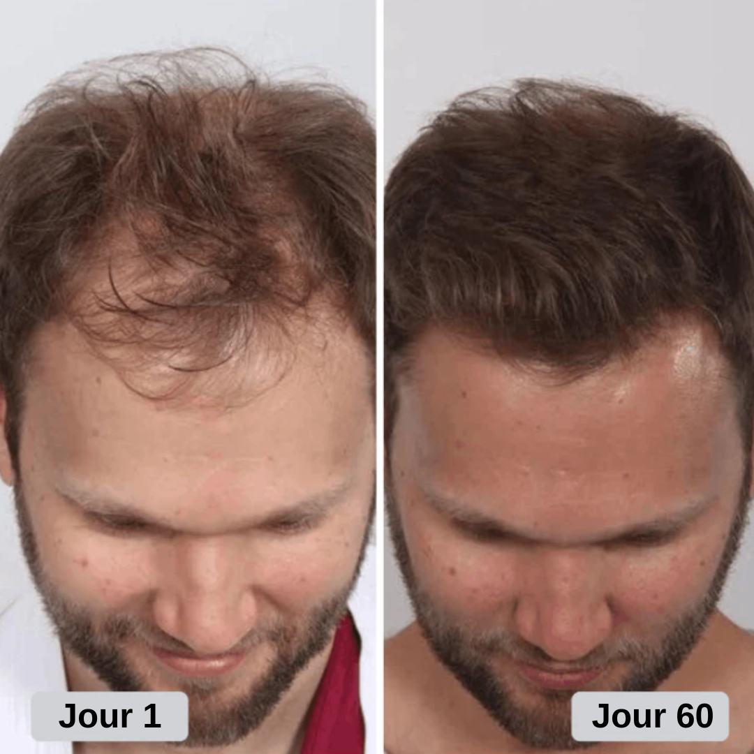 Casquette Renaissance Capillaire