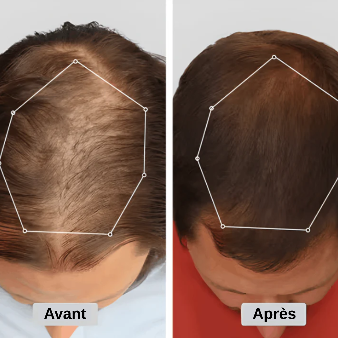 Casquette Renaissance Capillaire